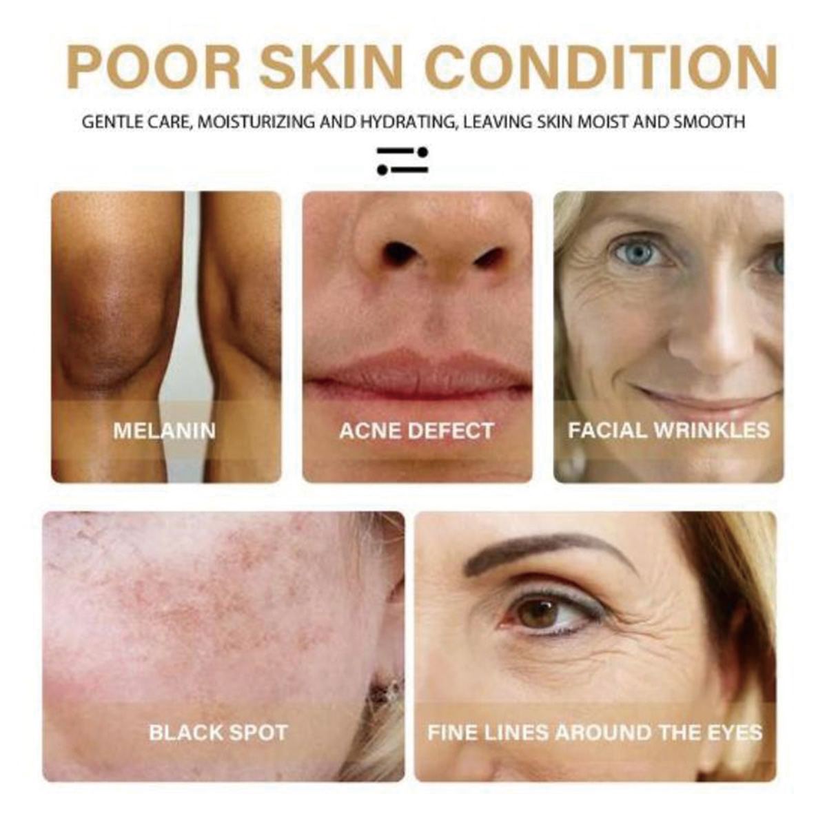 Essência facial de vitamina E  - Substrate Coconut Fiber avaliação e preço